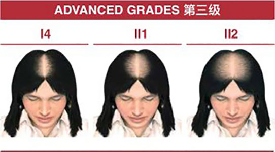 訂單管理系統(tǒng)